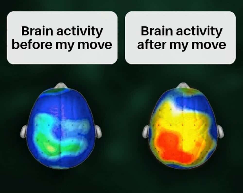 Brain activity before and after my move with colorful brain scans.
