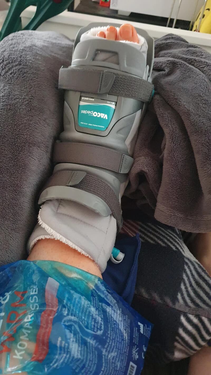 Medical boot on patient's foot with straps and a label, resting on a person's lap.